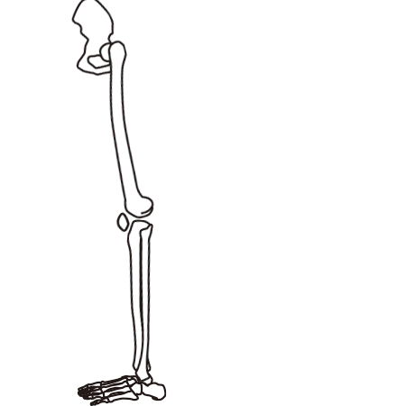 過伸展する膝関節