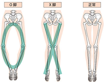 脚の形状