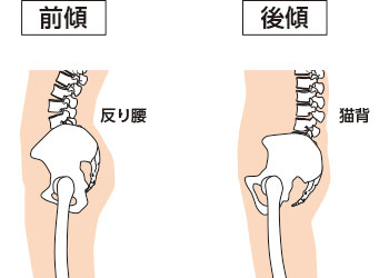 骨盤の前傾と後傾